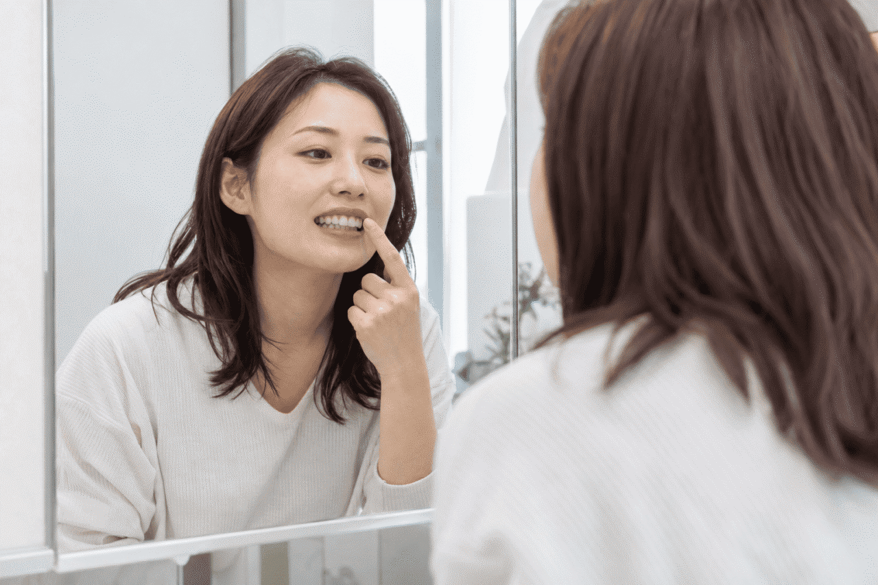 出っ歯の特徴を確認するためのセルフチェックイメージ